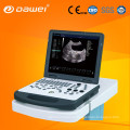 УЗИ 4D машина для тест на беременность &amp; ультразвука doppler цвета цена ДГ-C80Plus